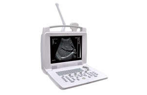ML-3018I Digital Portable Ultrasound Diagnostic