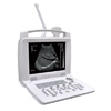 ML-3018I Digital Portable Ultrasound Diagnostic