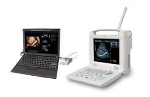 ML-3018I 3D Ultrasound Scanner 