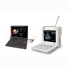 3D Ultrasound Scanner
